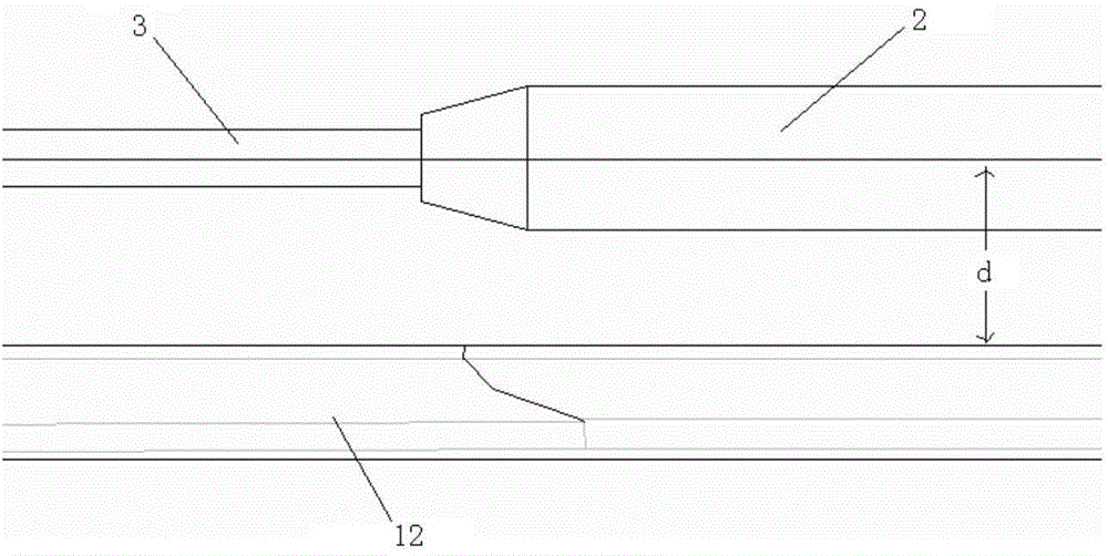 Shoulder joint scapula glenoid bone positioning device