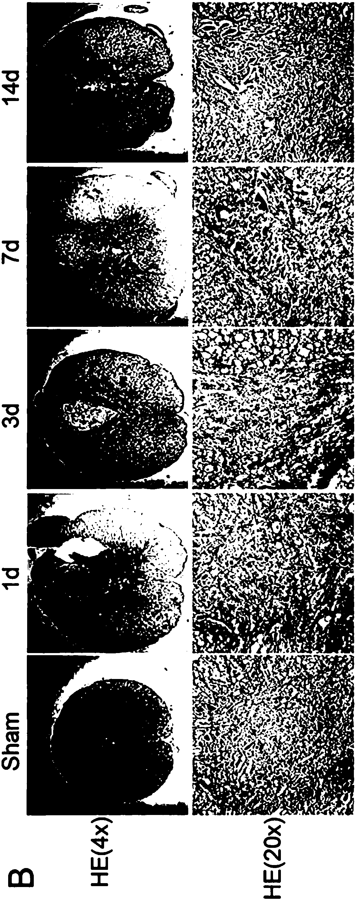 Application of chloroquine to promote spinal cord damage repair