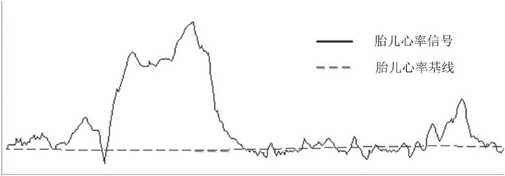 Baseline identification method for fetal heart rate curve