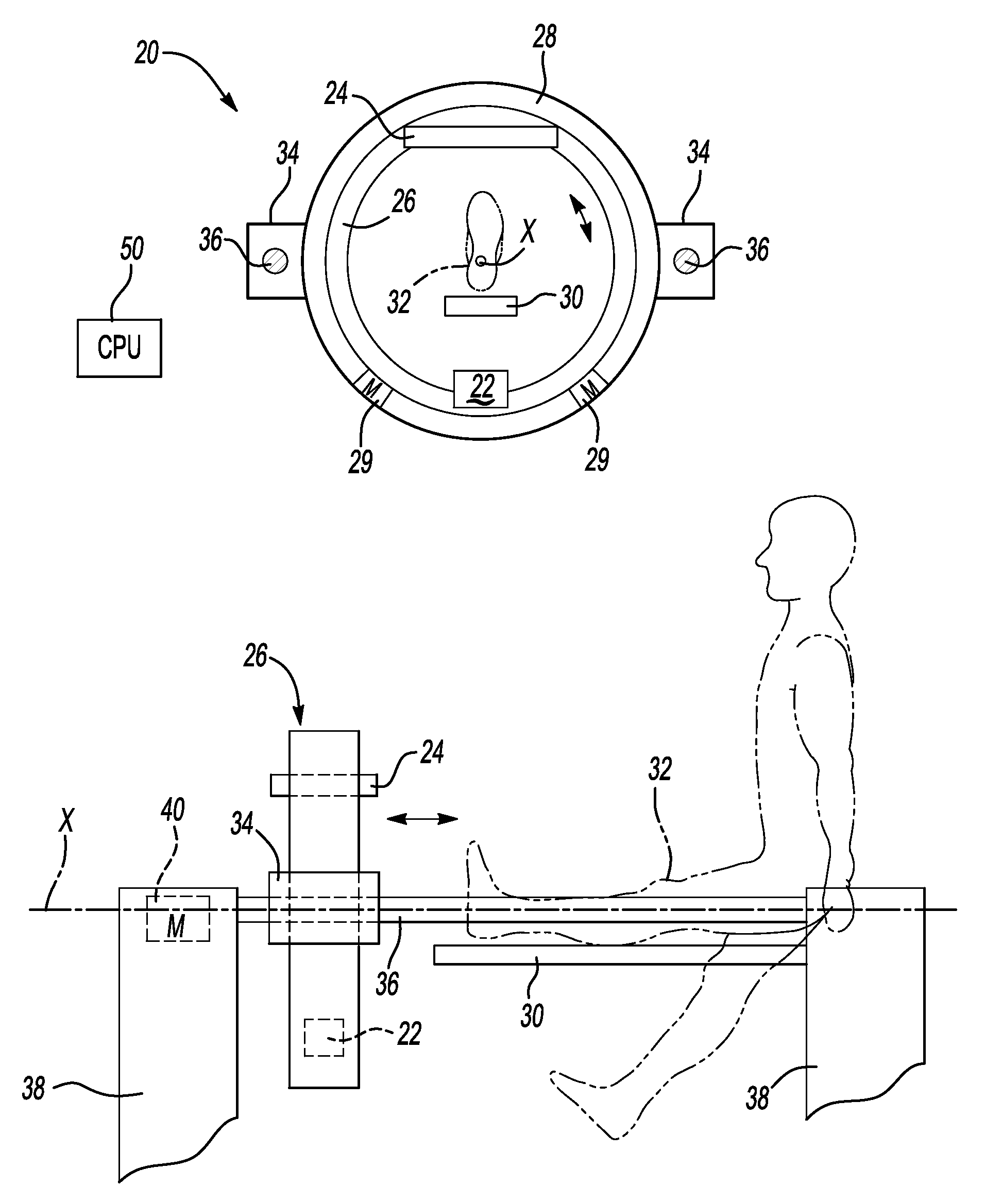 CT extremity scanner