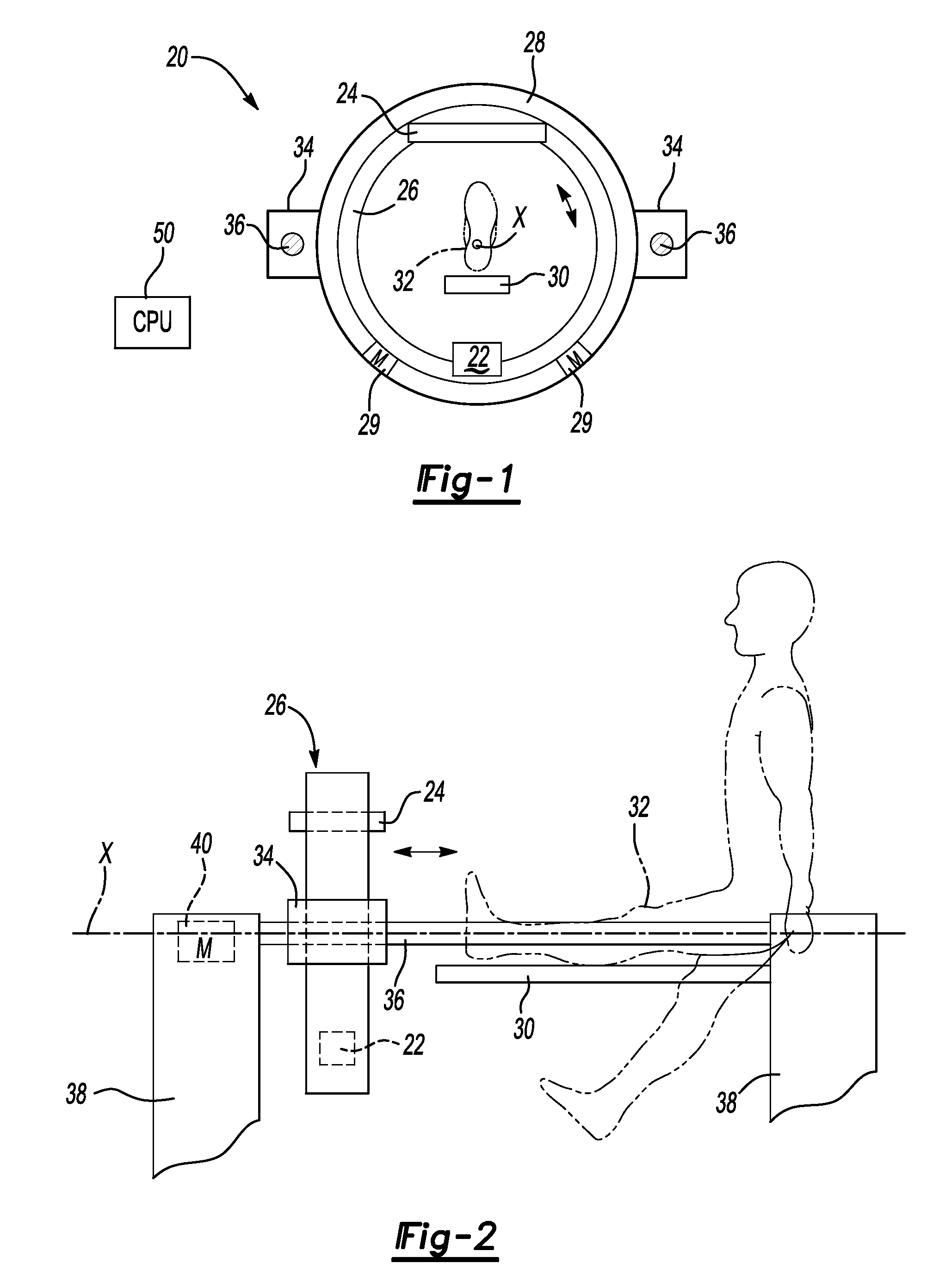 CT extremity scanner