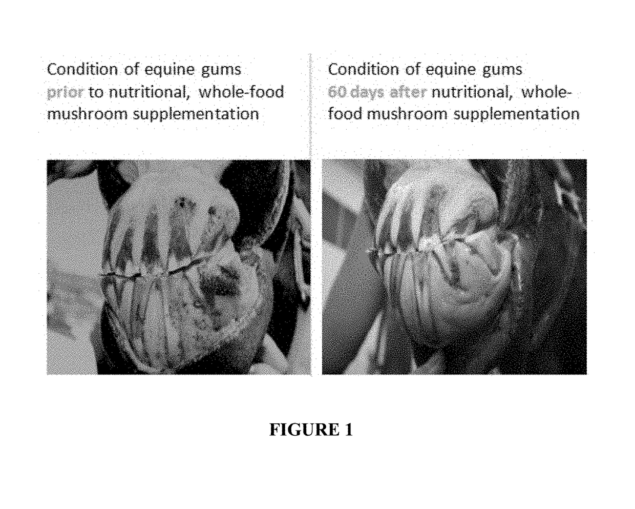 Nutritional approach to the control of anemia, diabetes and other diseases or conditions and prevention of associated comorbid states with the use of ergothioneine