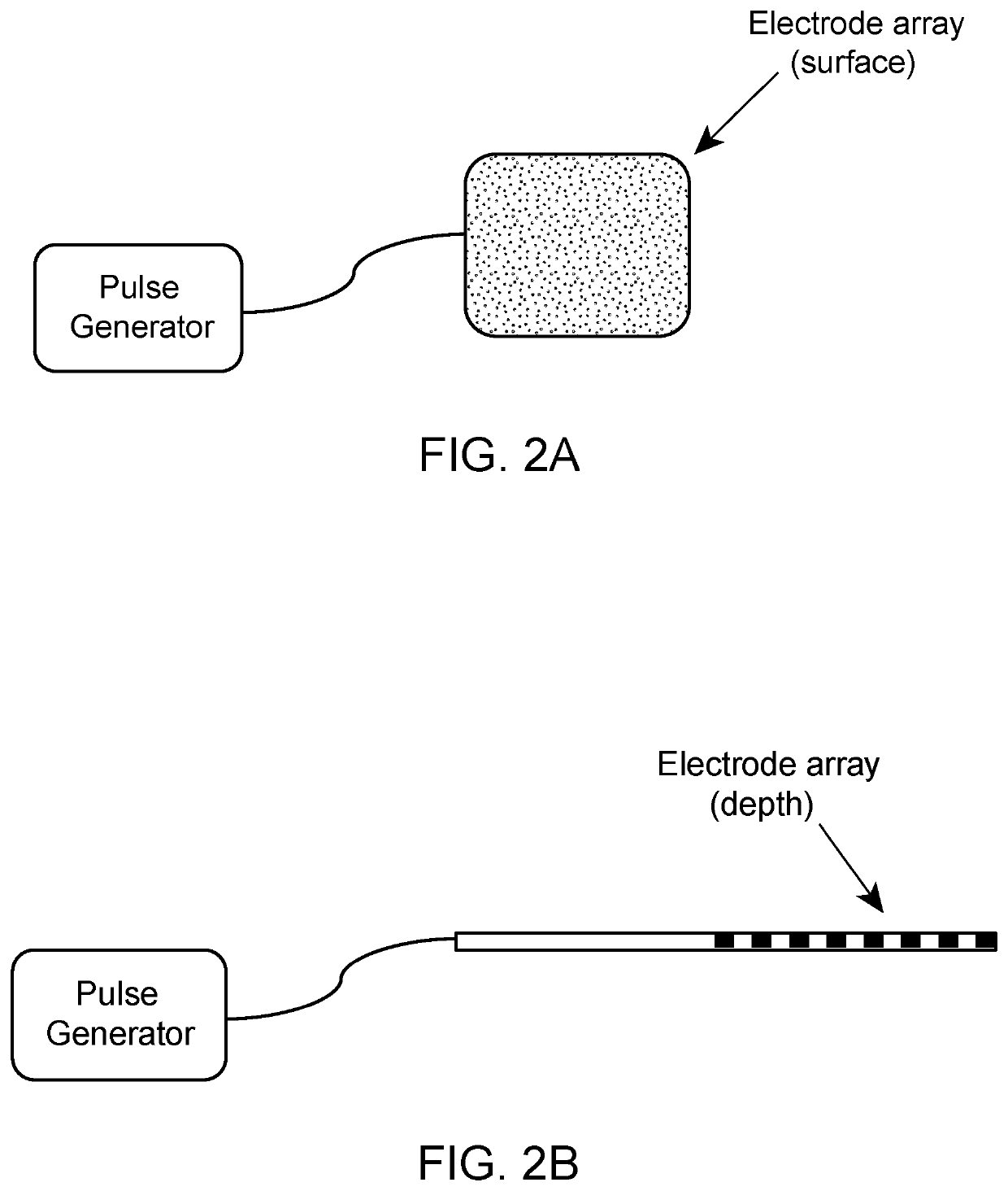 Method of neural Intervention for the Treatment of Affective Neuropsychiatric Disorders