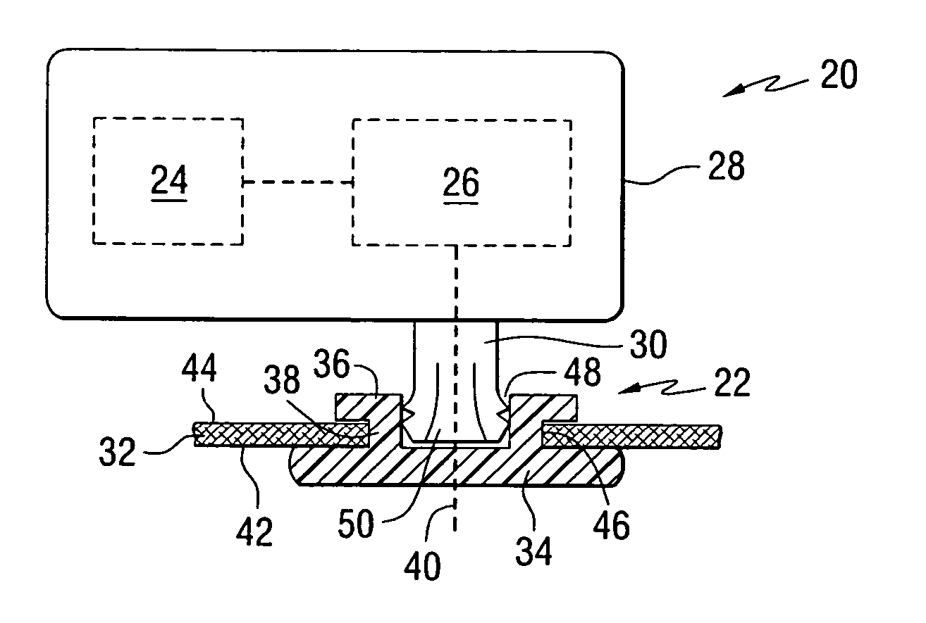 Bone conduction hearing aid fastening device