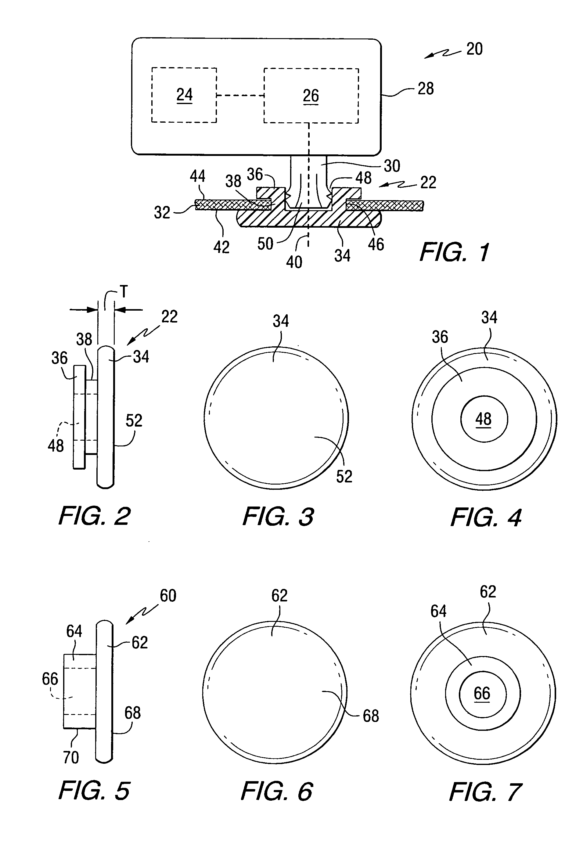 Bone conduction hearing aid fastening device