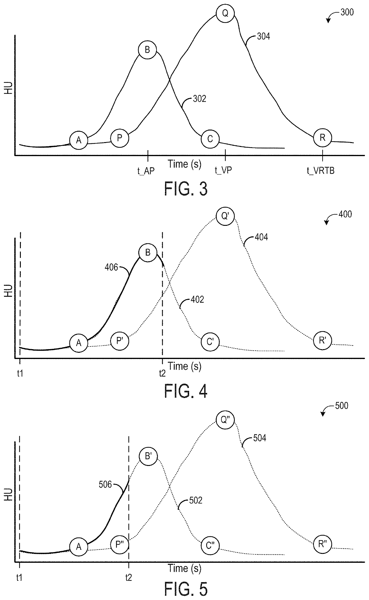 Methods and systems for an adaptive five-zone perfusion scan