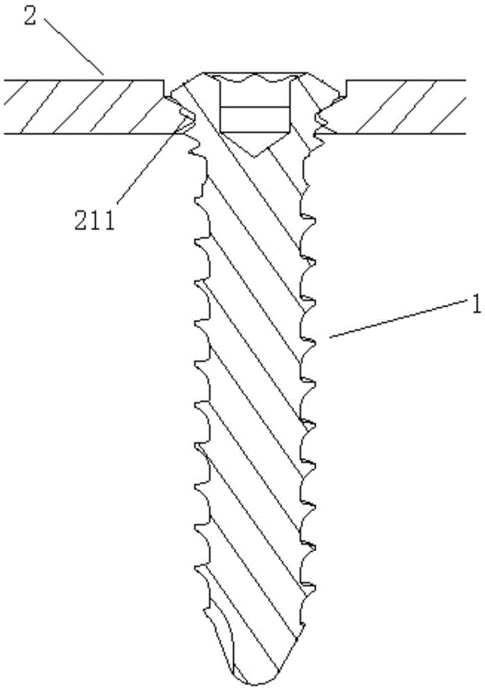 Small bone clamping device