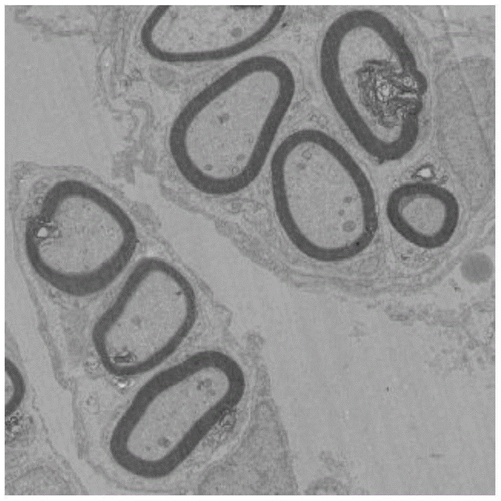 Method for preparing conductive polymer nano nerve conduit material