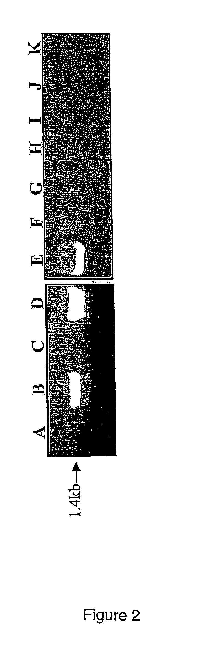 Plant resistance gene