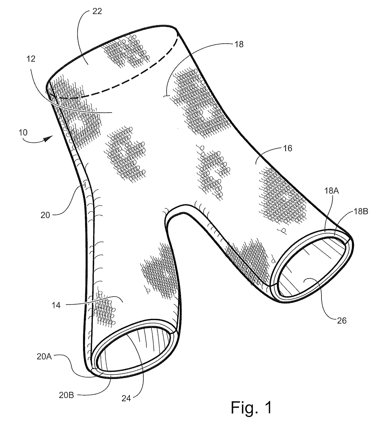 Hip spica cast and undergarment for use with hip spica cast