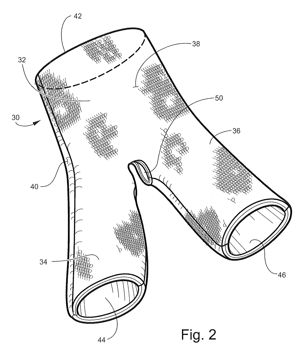 Hip spica cast and undergarment for use with hip spica cast