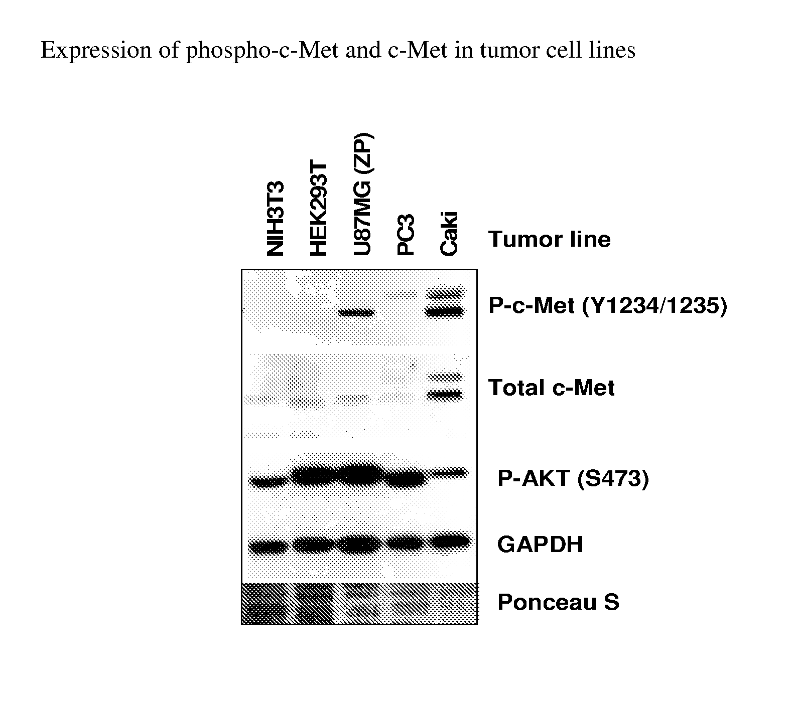 Substituted pyridazine carboxamide compounds as kinase inhibitor compounds