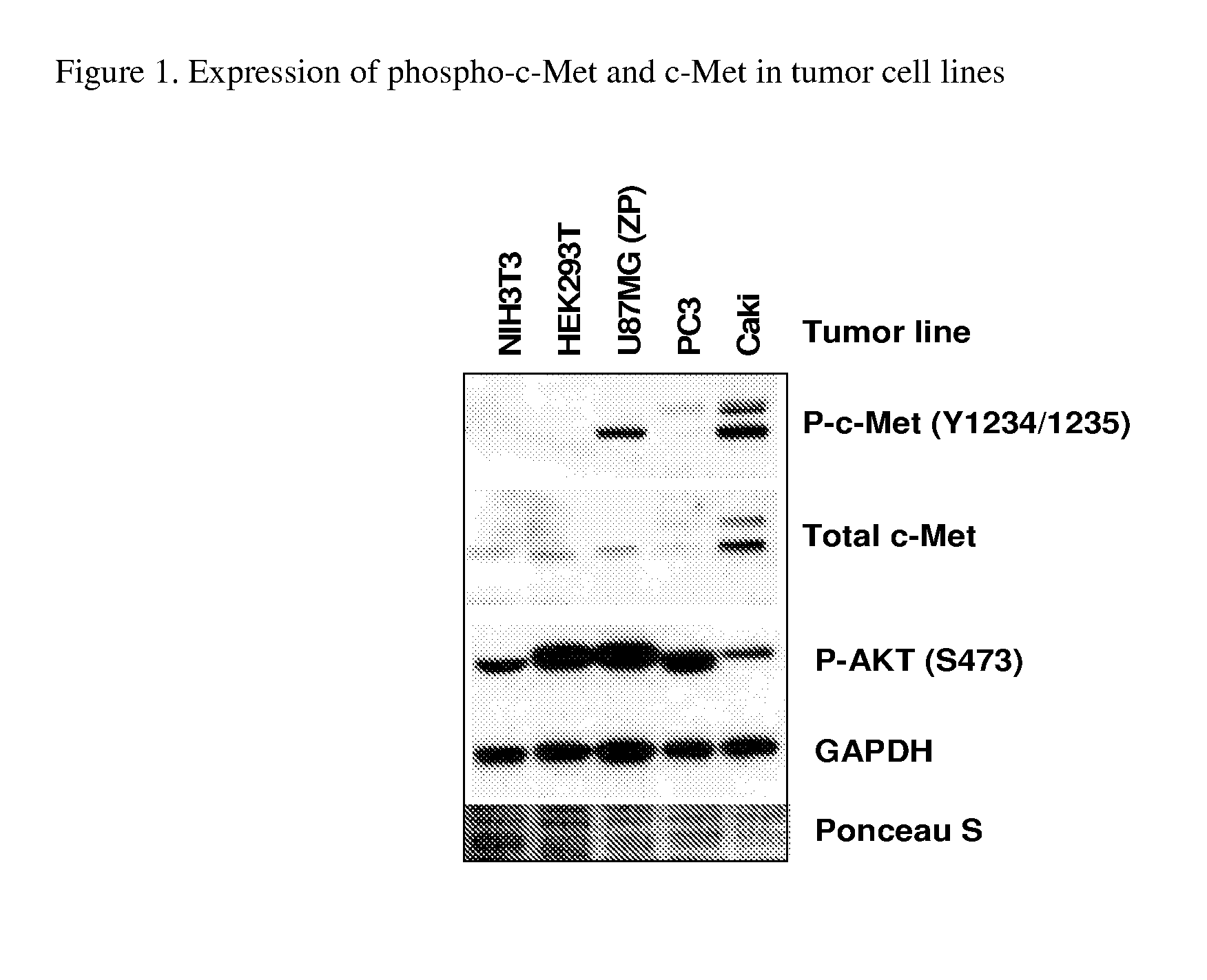 Substituted pyridazine carboxamide compounds as kinase inhibitor compounds