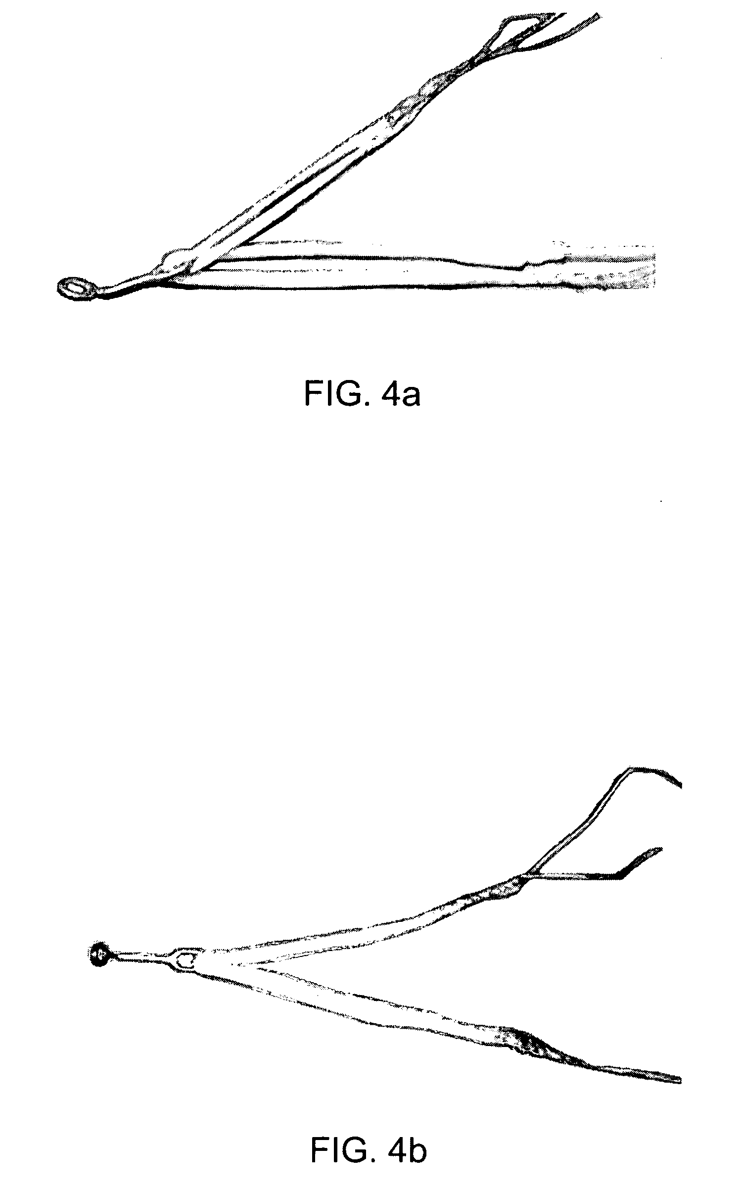 Intraosseous fixation device for reconstructing the knee posterior cruciate ligament