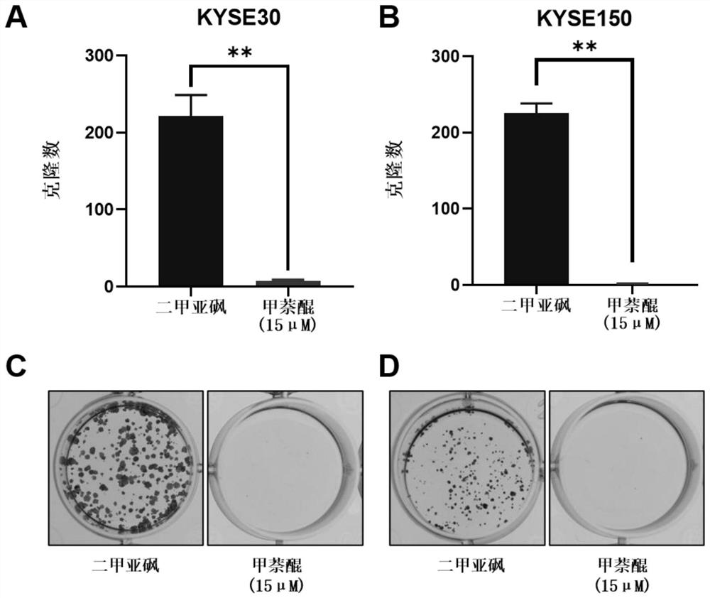 Application of menadione in preparation of medicine for treating esophageal squamous cell carcinoma and/or inhibiting proliferation and metastasis of esophageal squamous cell carcinoma