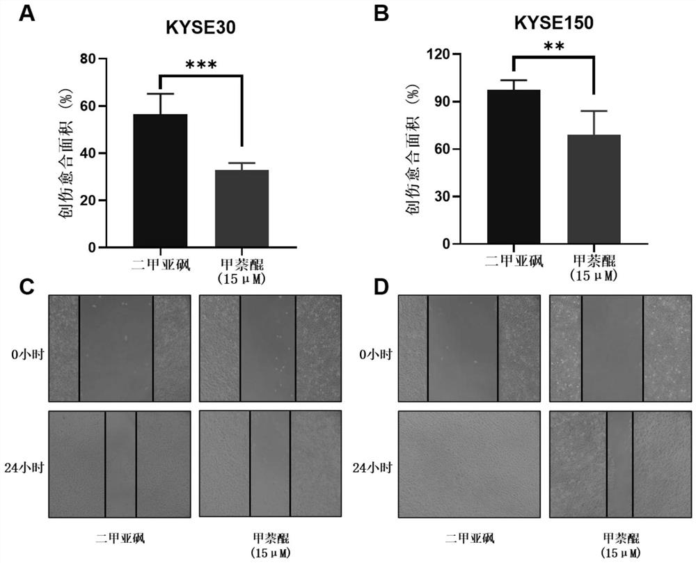 Application of menadione in preparation of medicine for treating esophageal squamous cell carcinoma and/or inhibiting proliferation and metastasis of esophageal squamous cell carcinoma