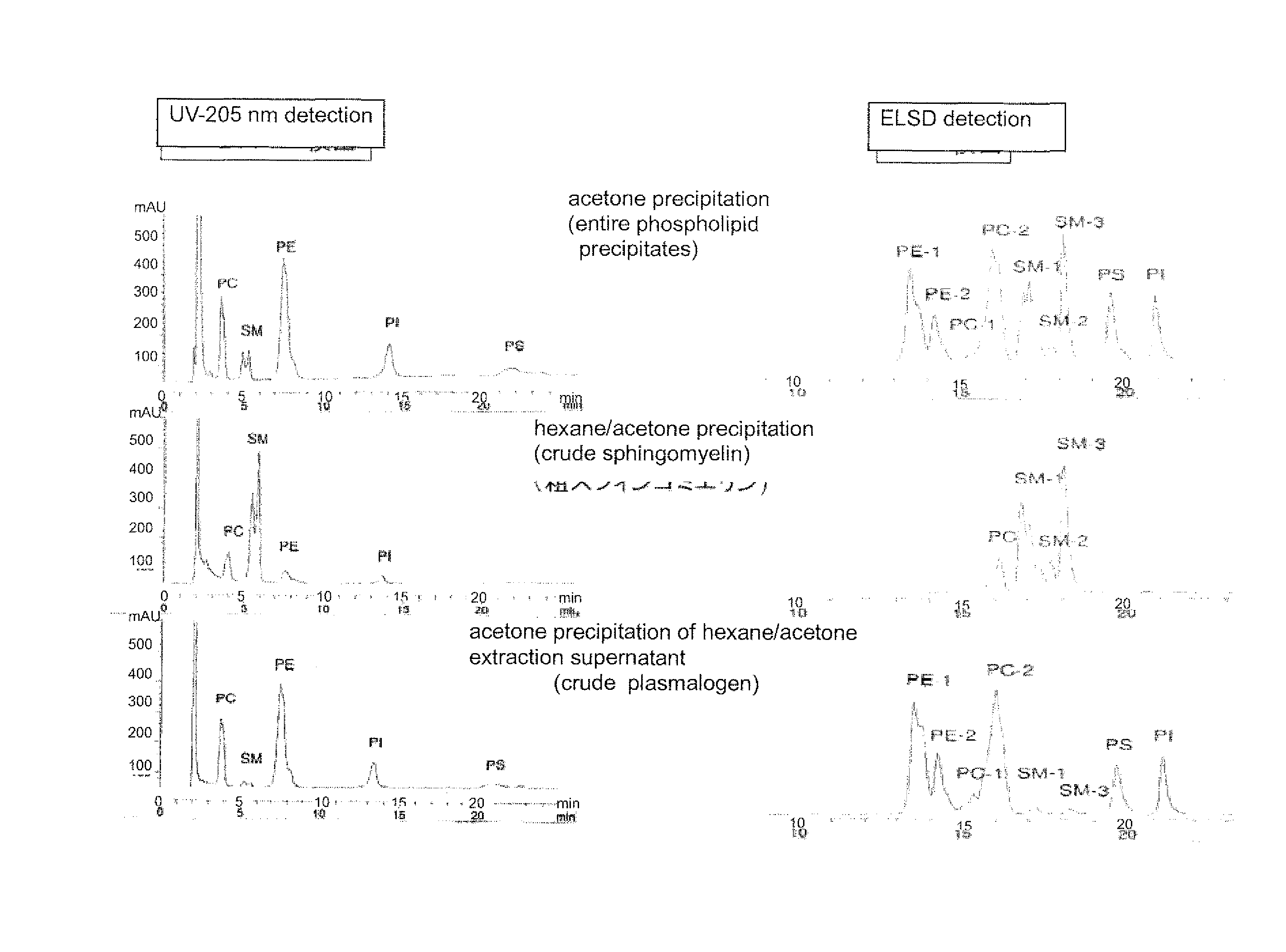 Process for producing sphingomyelin and plasmalogen-form glycerophospholipid