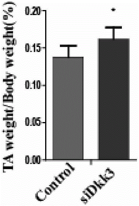 Application and related medicines of DKK3 gene