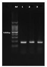 Method for detecting hotspot mutation of human TERT gene promoter