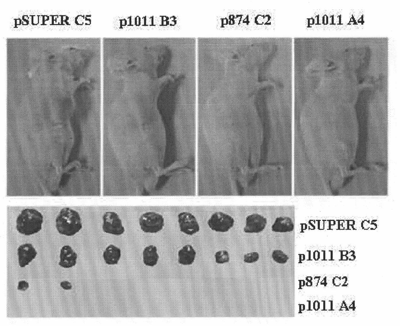 Ribonucleic acid taking liver cancer related gene DLK1 as target spot and application thereof