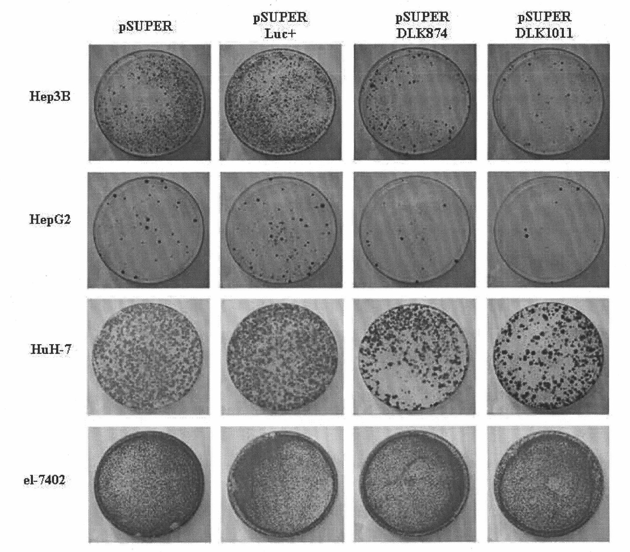 Ribonucleic acid taking liver cancer related gene DLK1 as target spot and application thereof