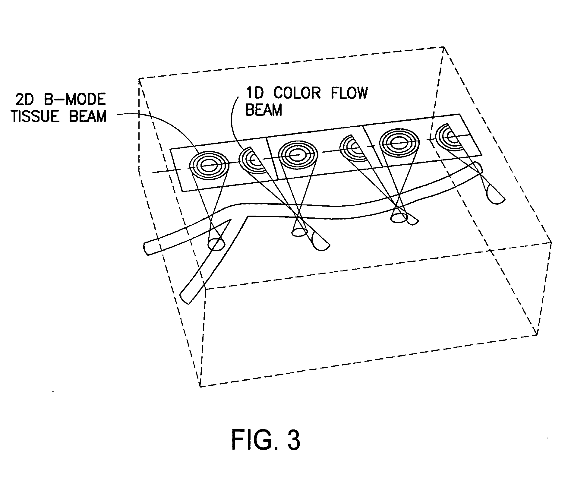 Continuous, non-invasive technique for determining blood pressure using a transmission line model and transcutaneous ultrasound measurements