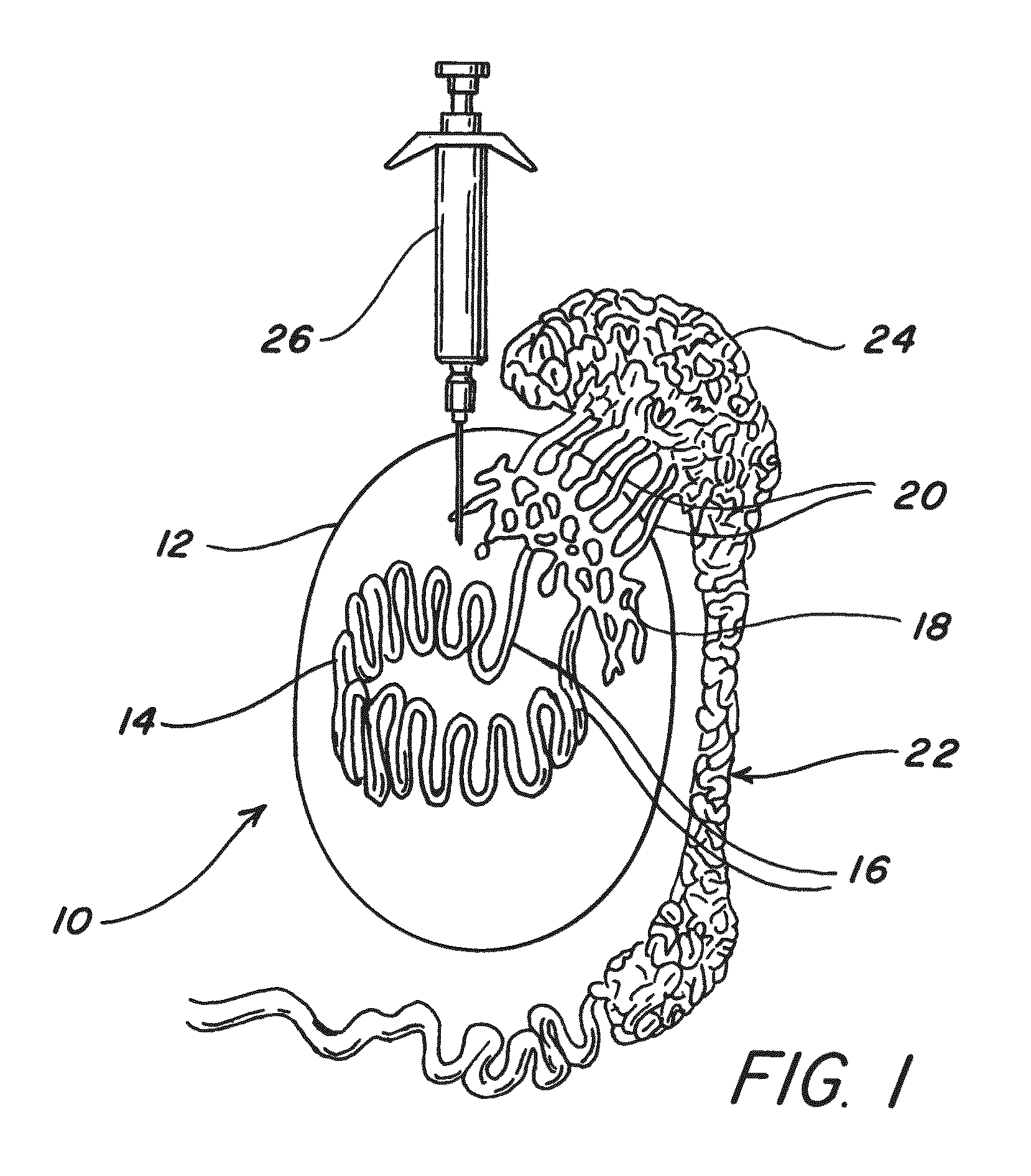 Method for improving the quality of meat by reducing boar taint