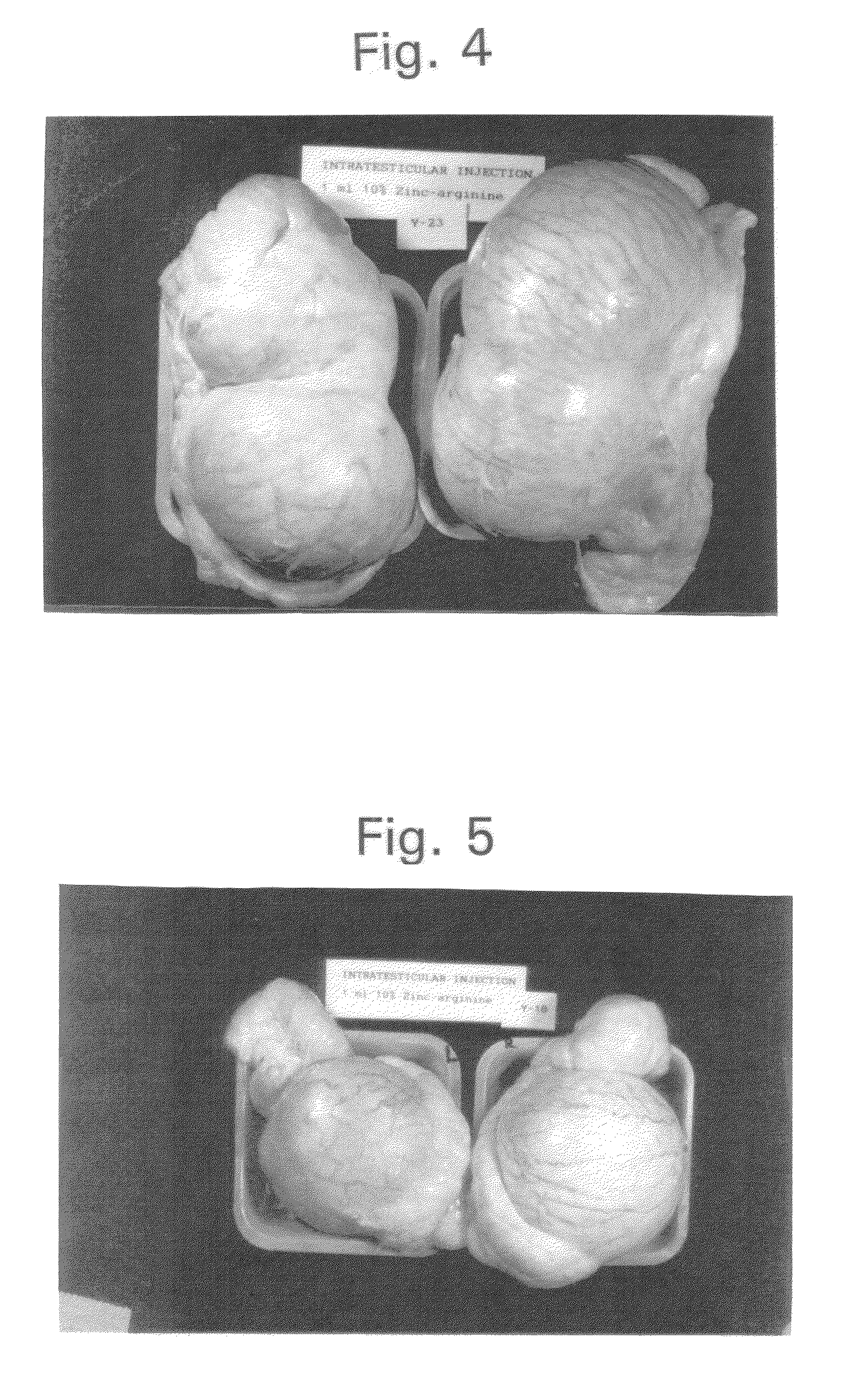 Method for improving the quality of meat by reducing boar taint