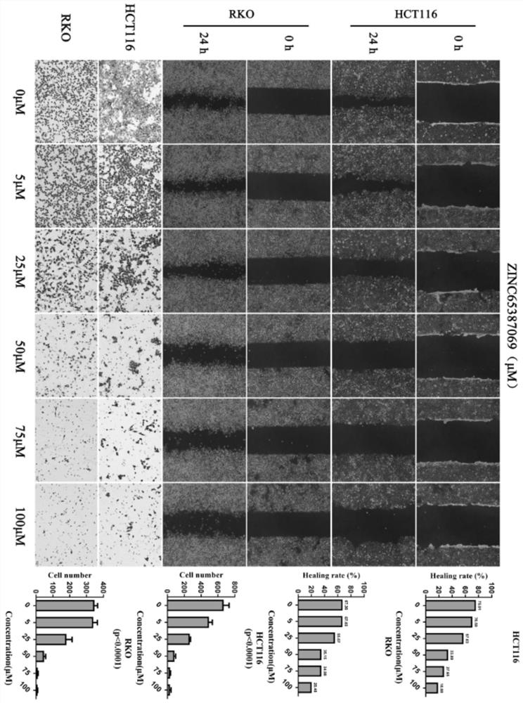 Application of a compound in the preparation of antitumor drugs