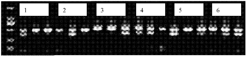 Kit for detecting drug resistance of culex pipiens and special primer thereof