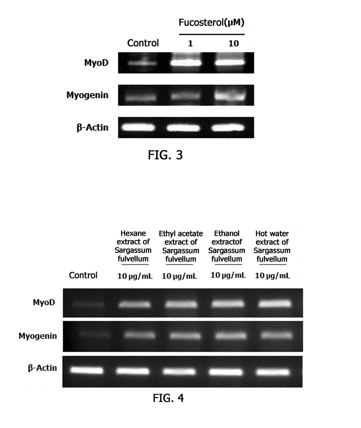 Composition for preventing, alleviating or treating muscle diseases or improving muscular function