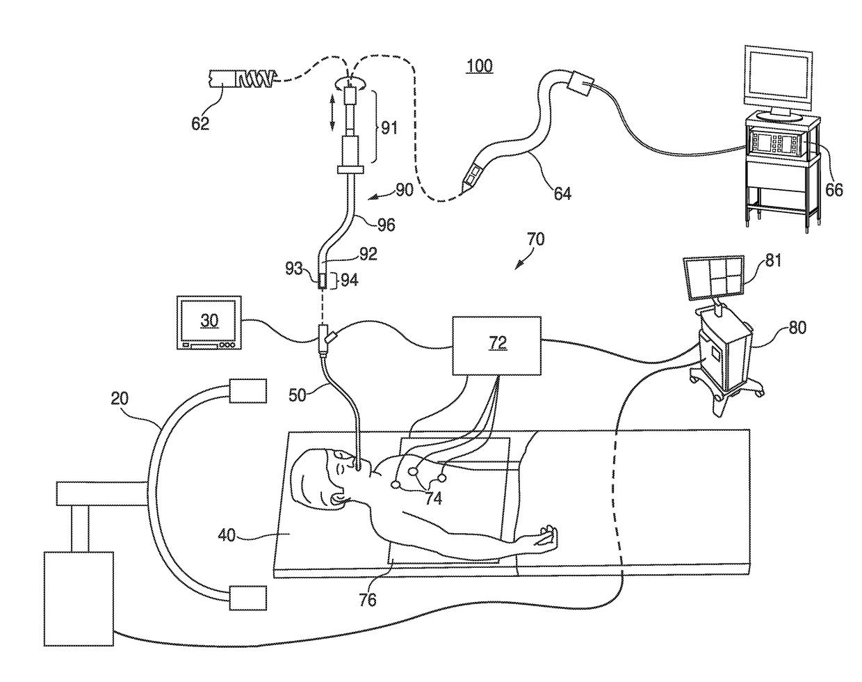 Visualization, navigation, and planning with electromagnetic navigation bronchoscopy and cone beam computed tomography integrated