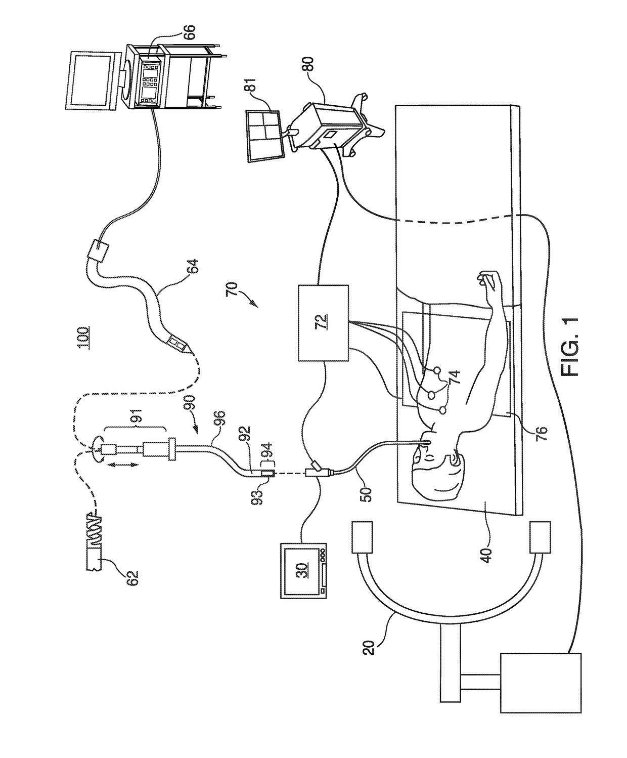 Visualization, navigation, and planning with electromagnetic navigation bronchoscopy and cone beam computed tomography integrated