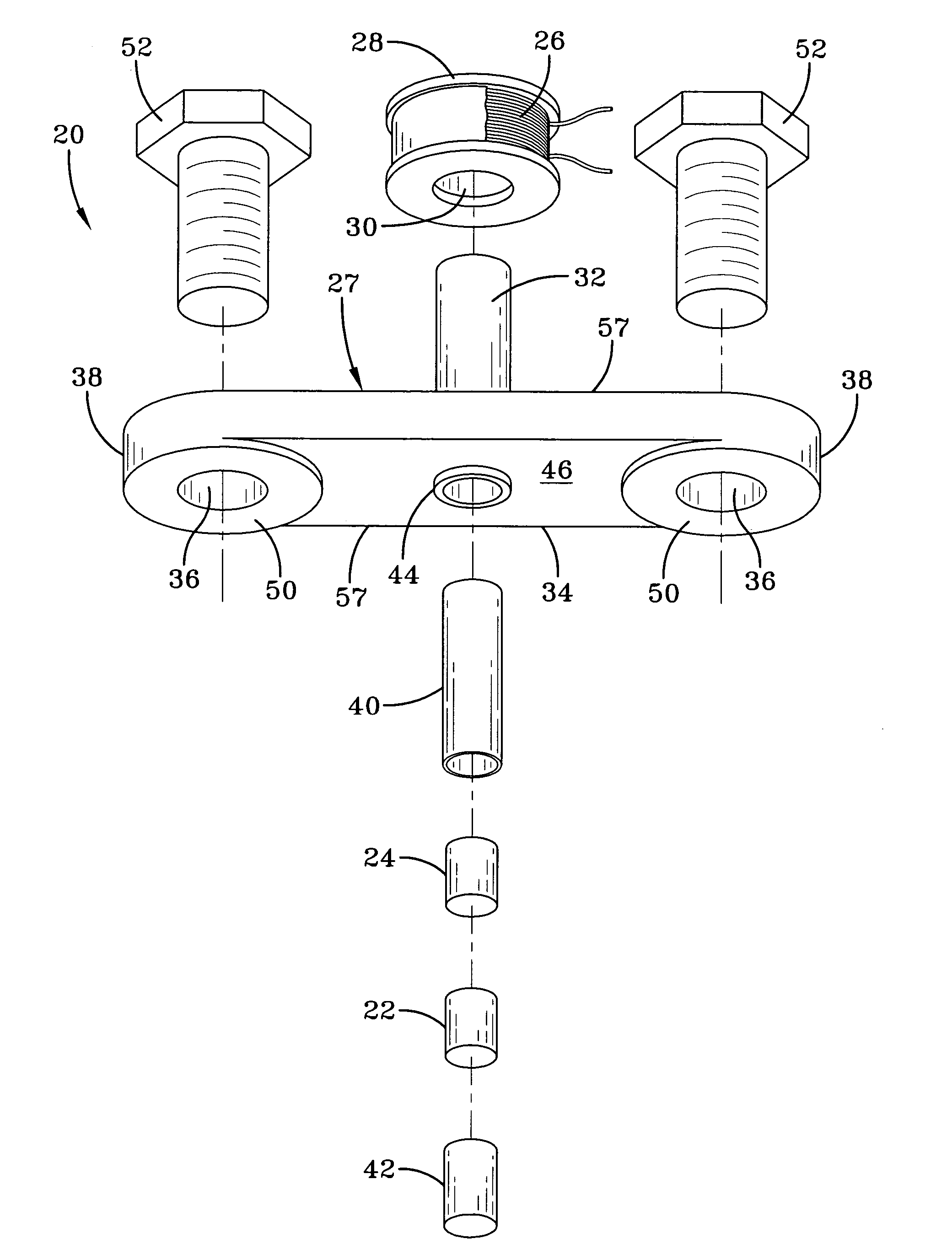 Magnetostrictive stress wave sensor