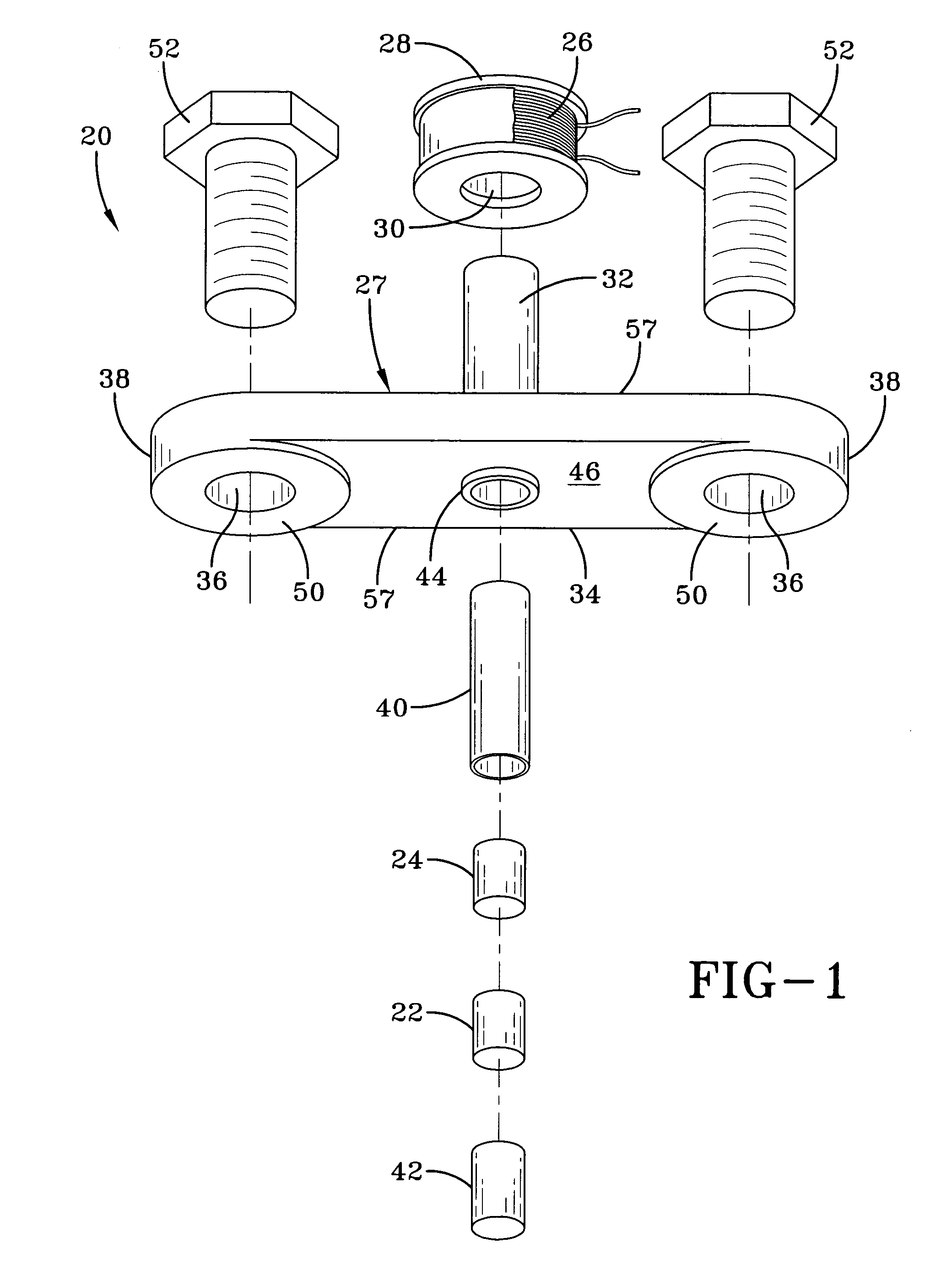 Magnetostrictive stress wave sensor