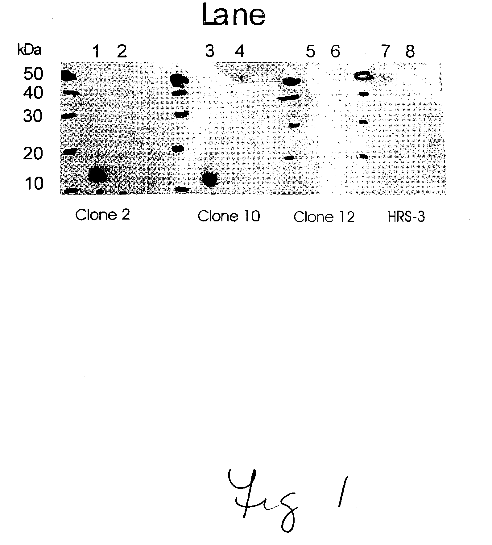 Humanized GM-CSF antibodies