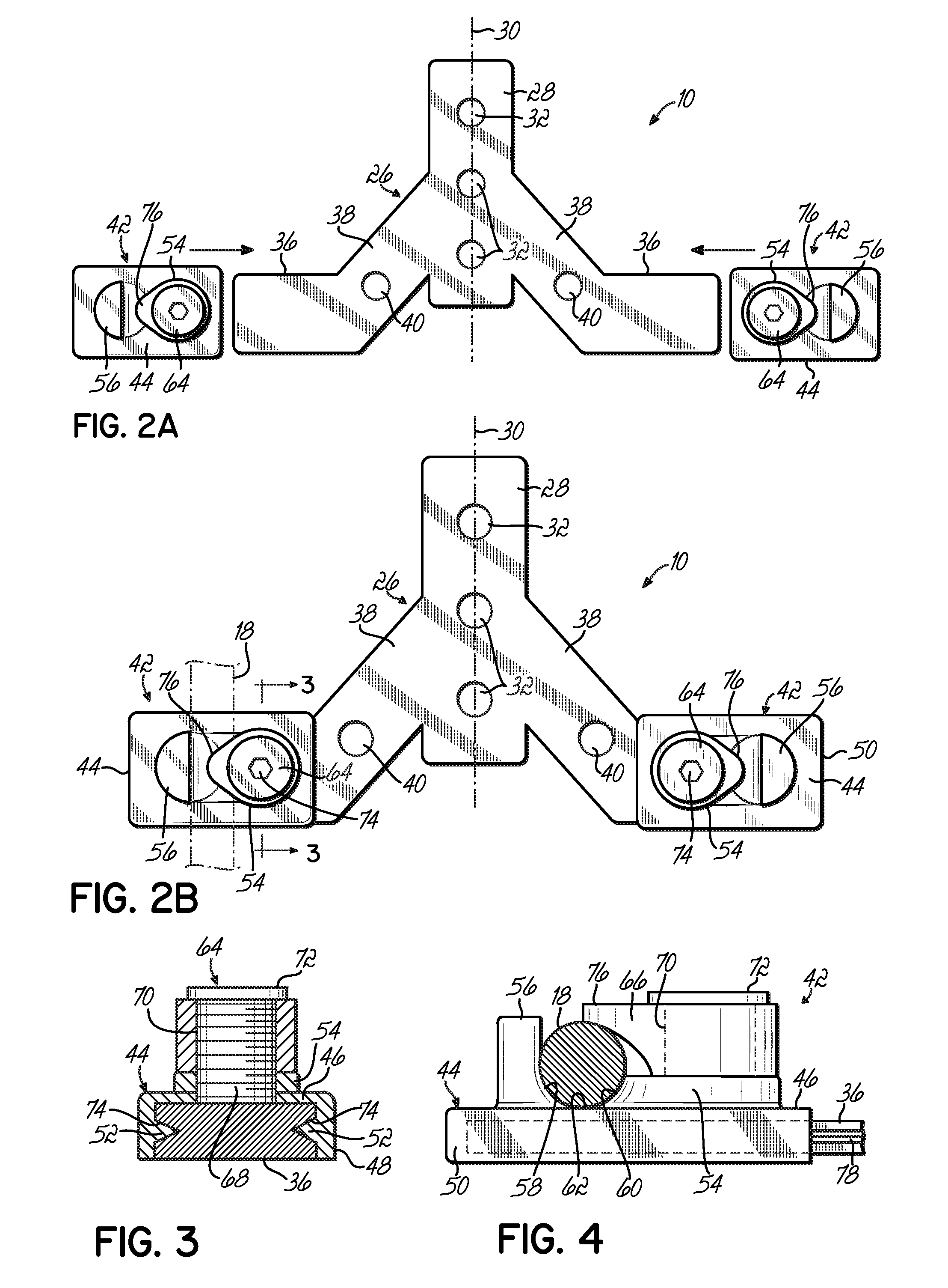 Adjustable Occipital Plate