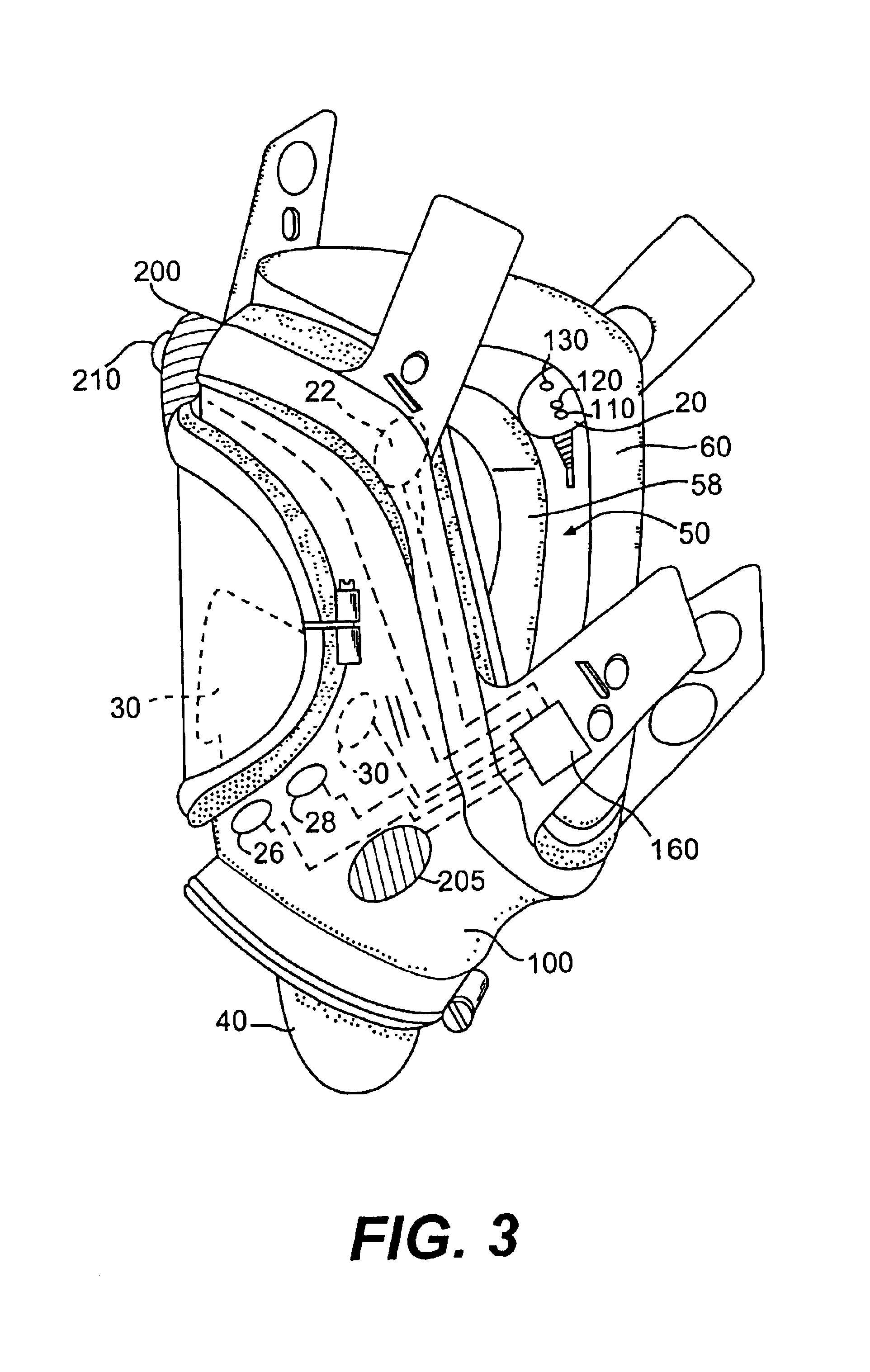 Integrated physiologic sensor system