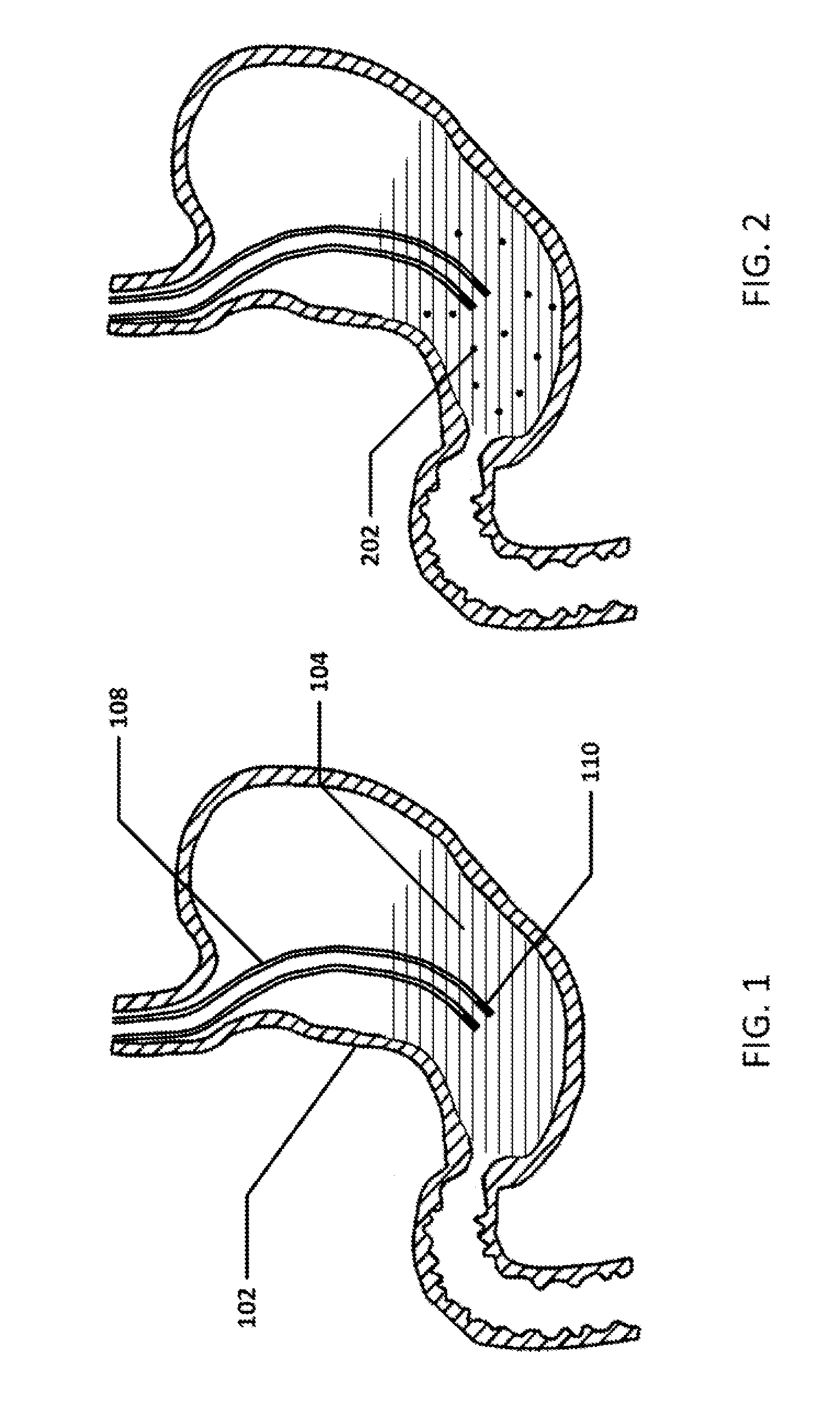 Devices and methods to measure gastric residual volume