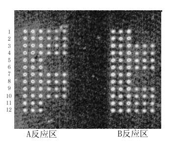 Detection kit and detection method for polymorphism of sheep BMPR-1B gene A746G