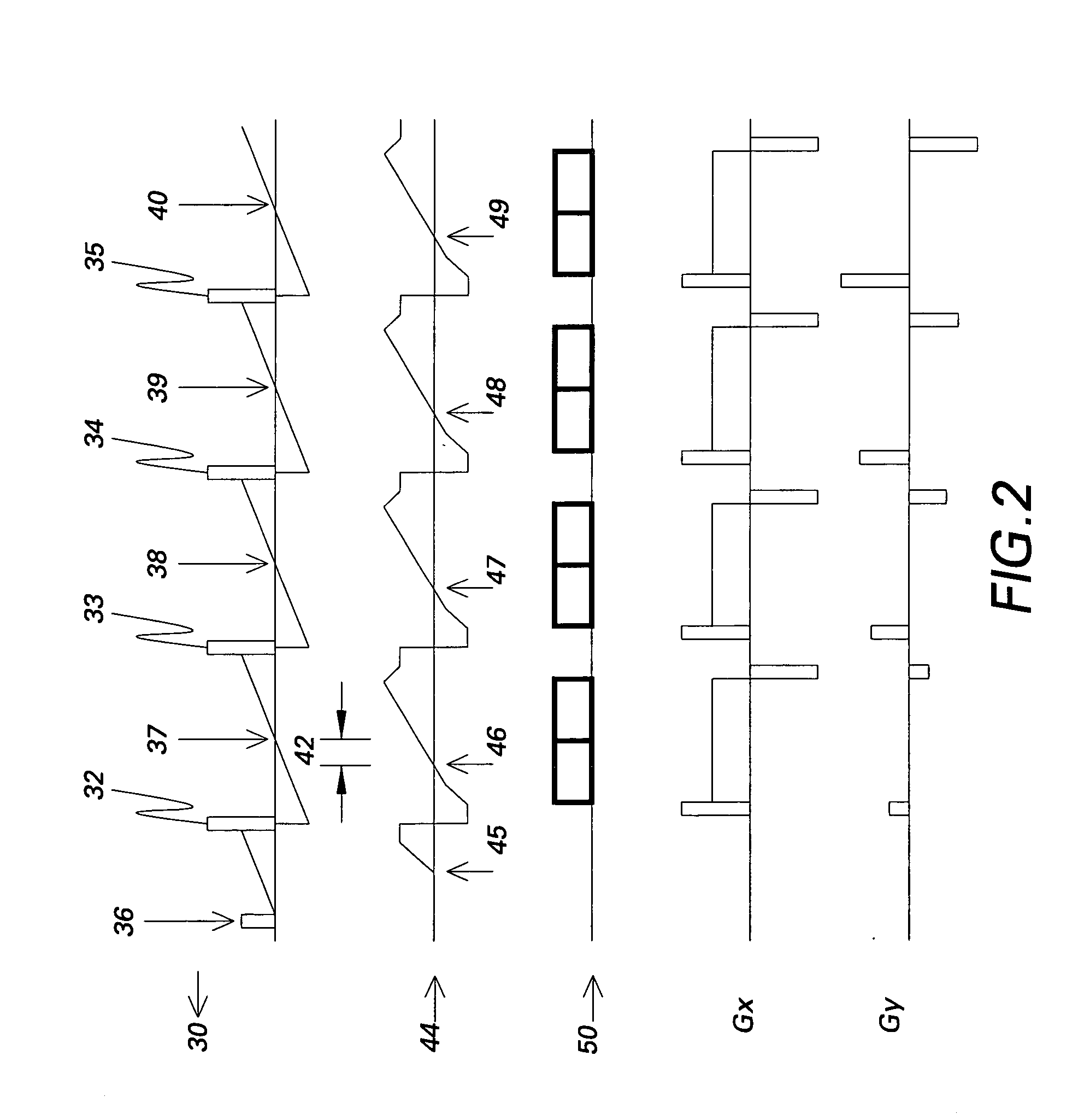 Magnetic resonance imaging system and method