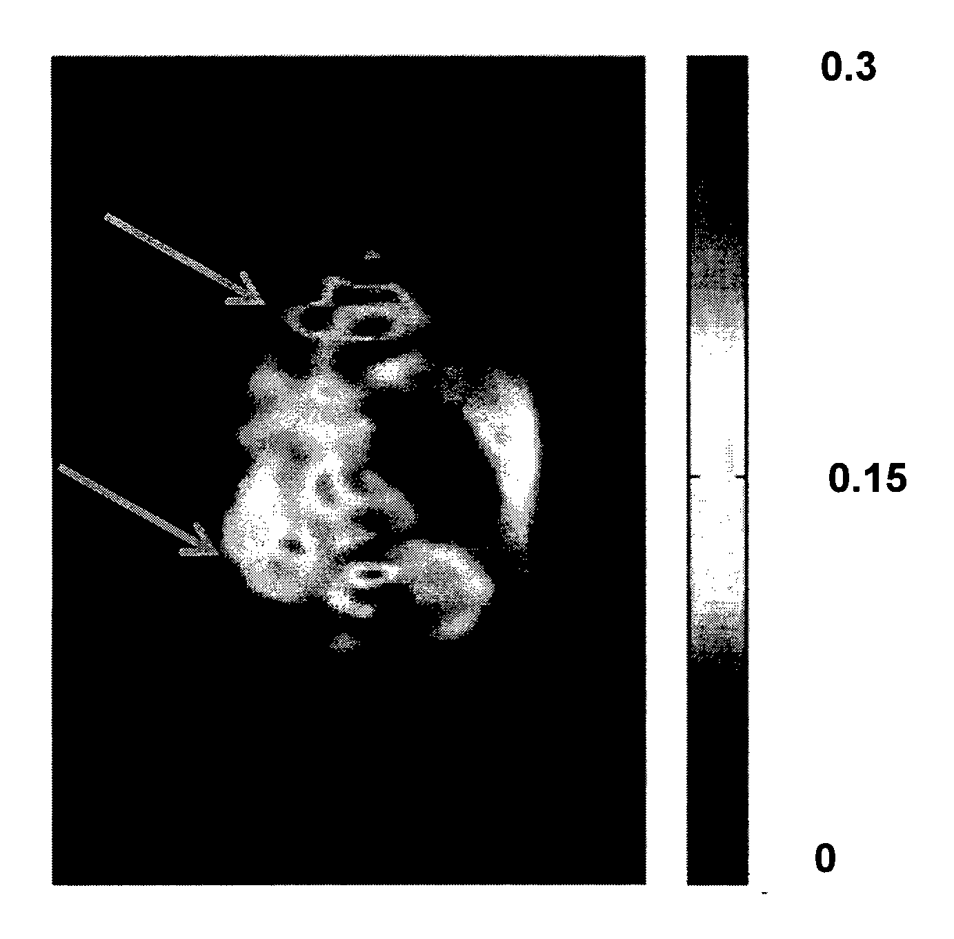 Isotopically labeled deoxy-glucose and derivatives thereof, compositions comprising them and uses thereof