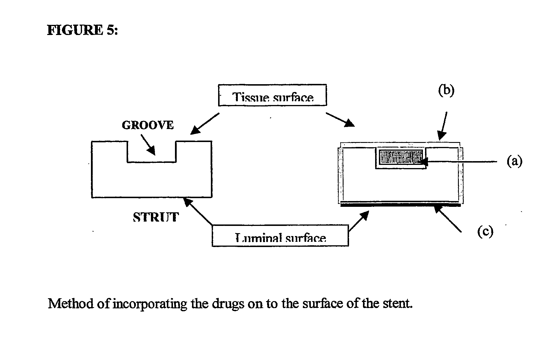 Stent with drug-delivery system