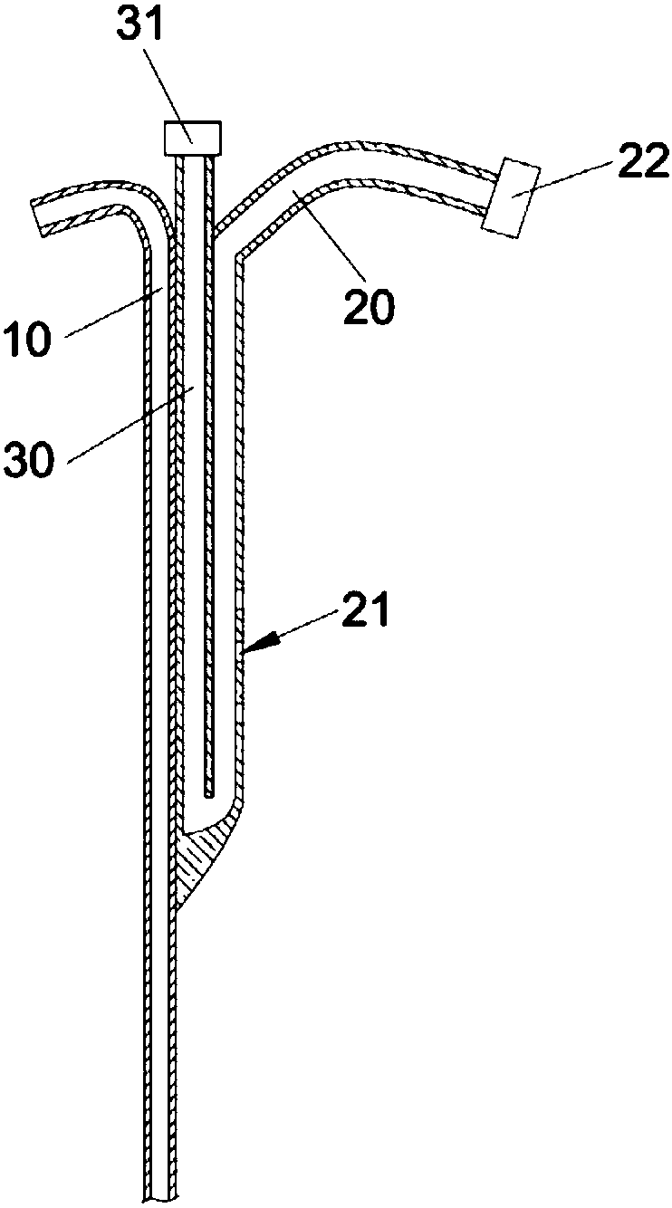 U-shaped anti-aspiration nasogastric tube