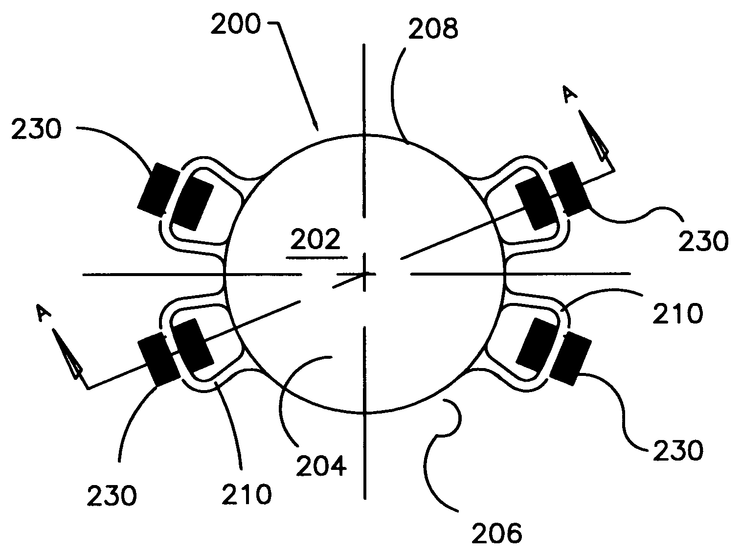 Refractive intraocular implant lens and method