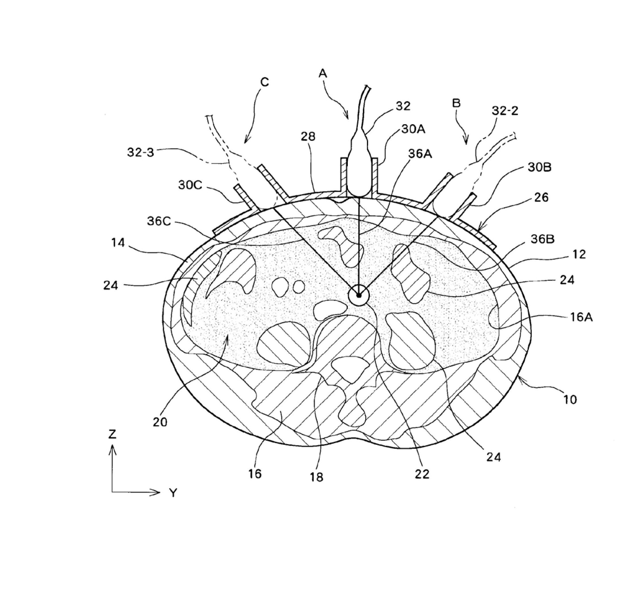 Ultrasonic diagnostic system