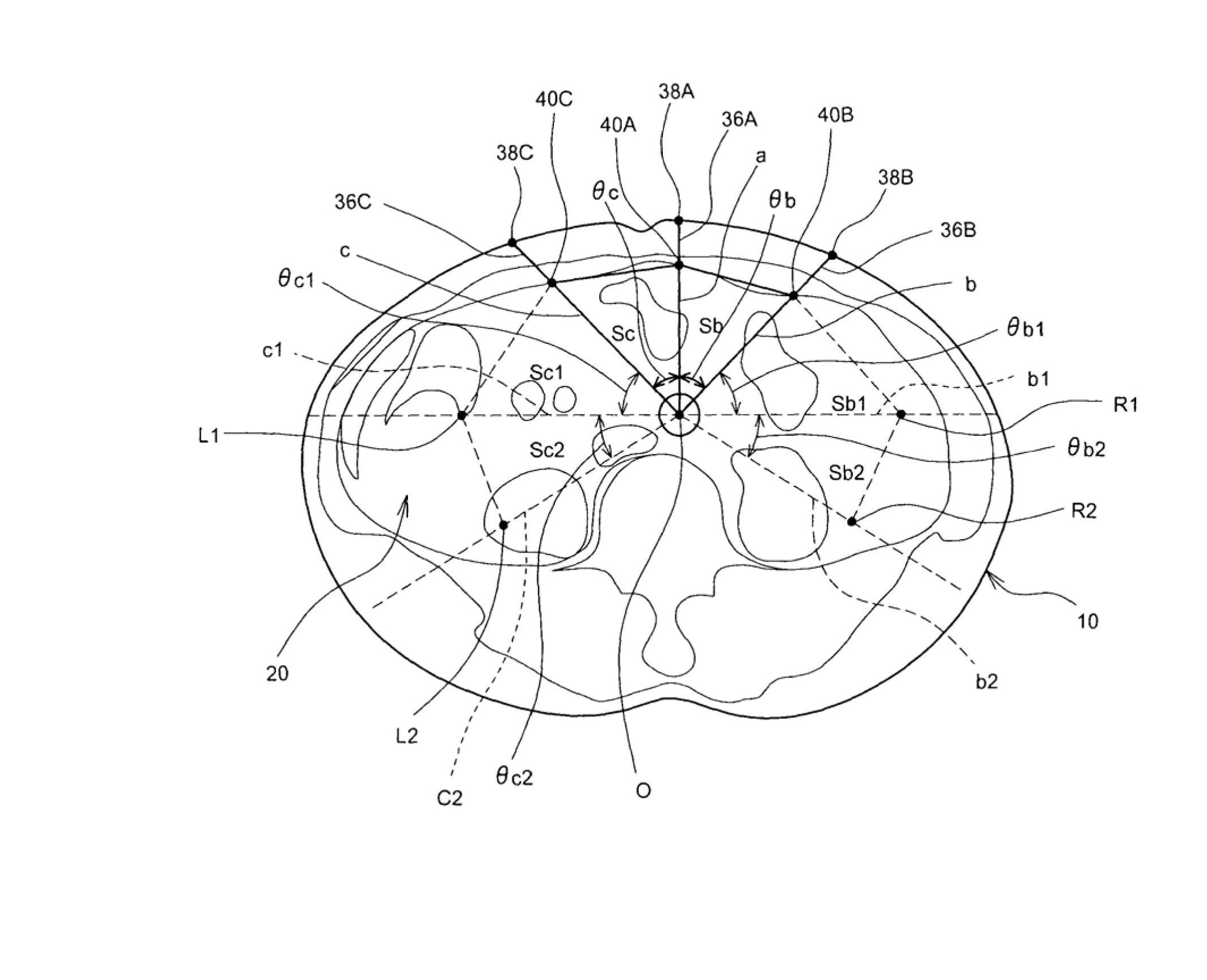 Ultrasonic diagnostic system