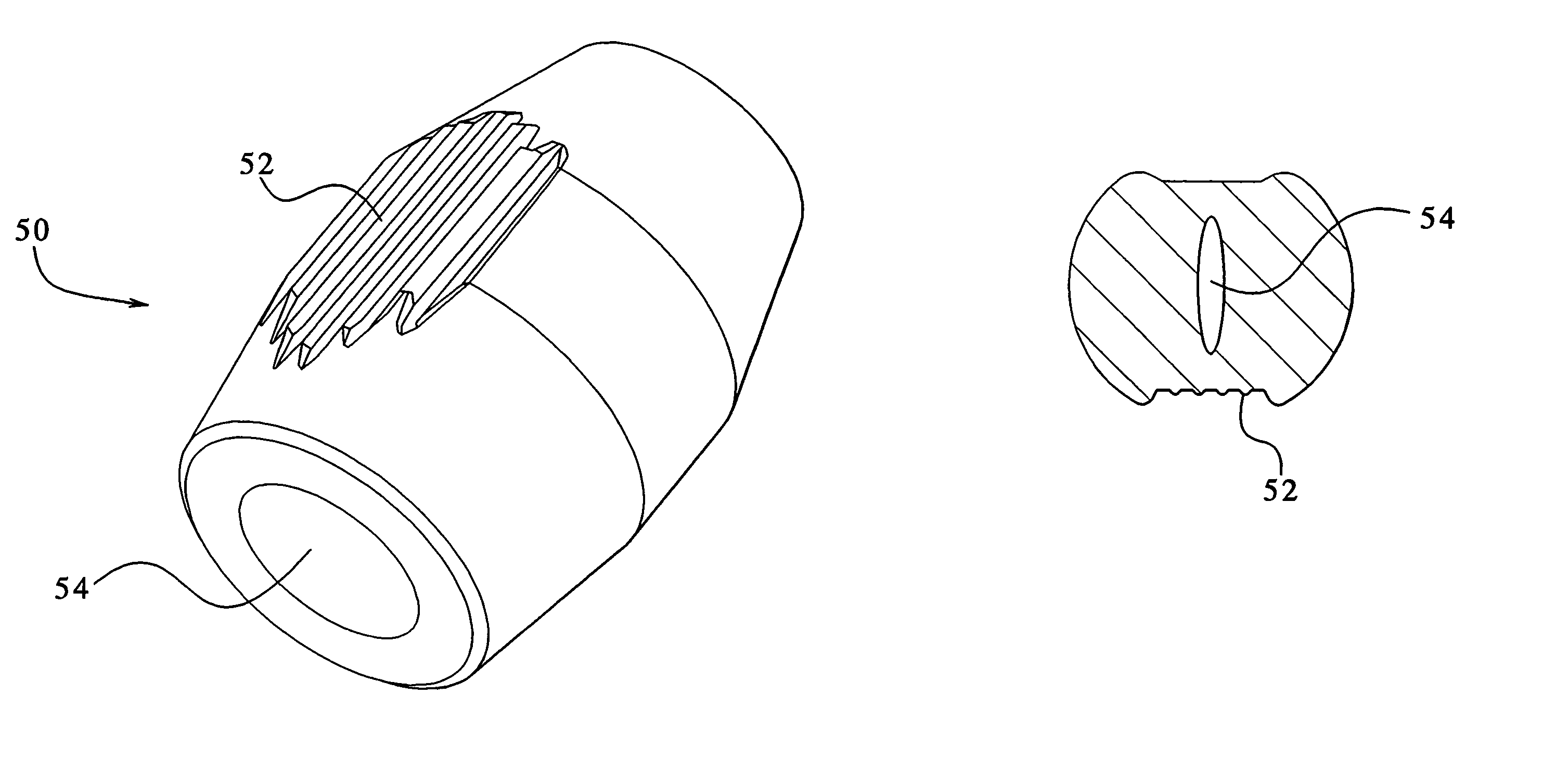 Catheter having insertion control mechanism