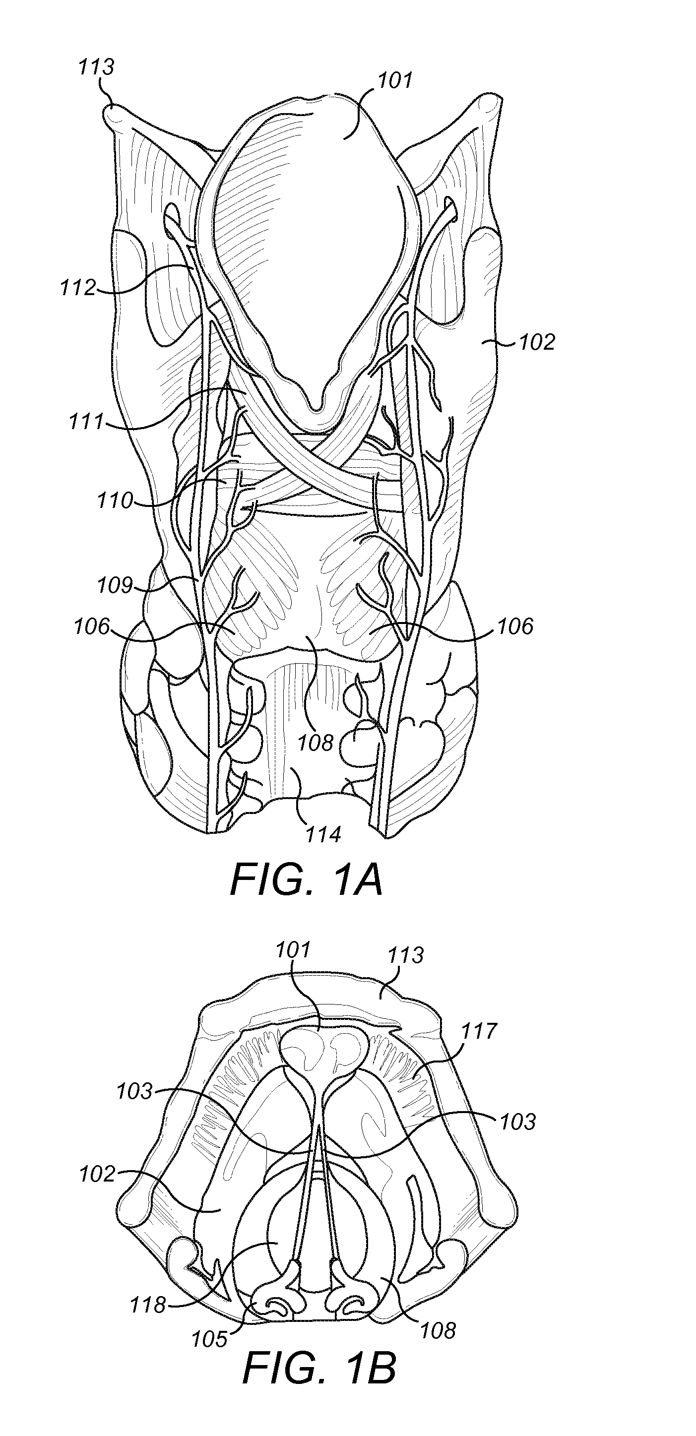 Respiration Sensors for Recording of Triggered Respiratory Signals in Neurostimulators