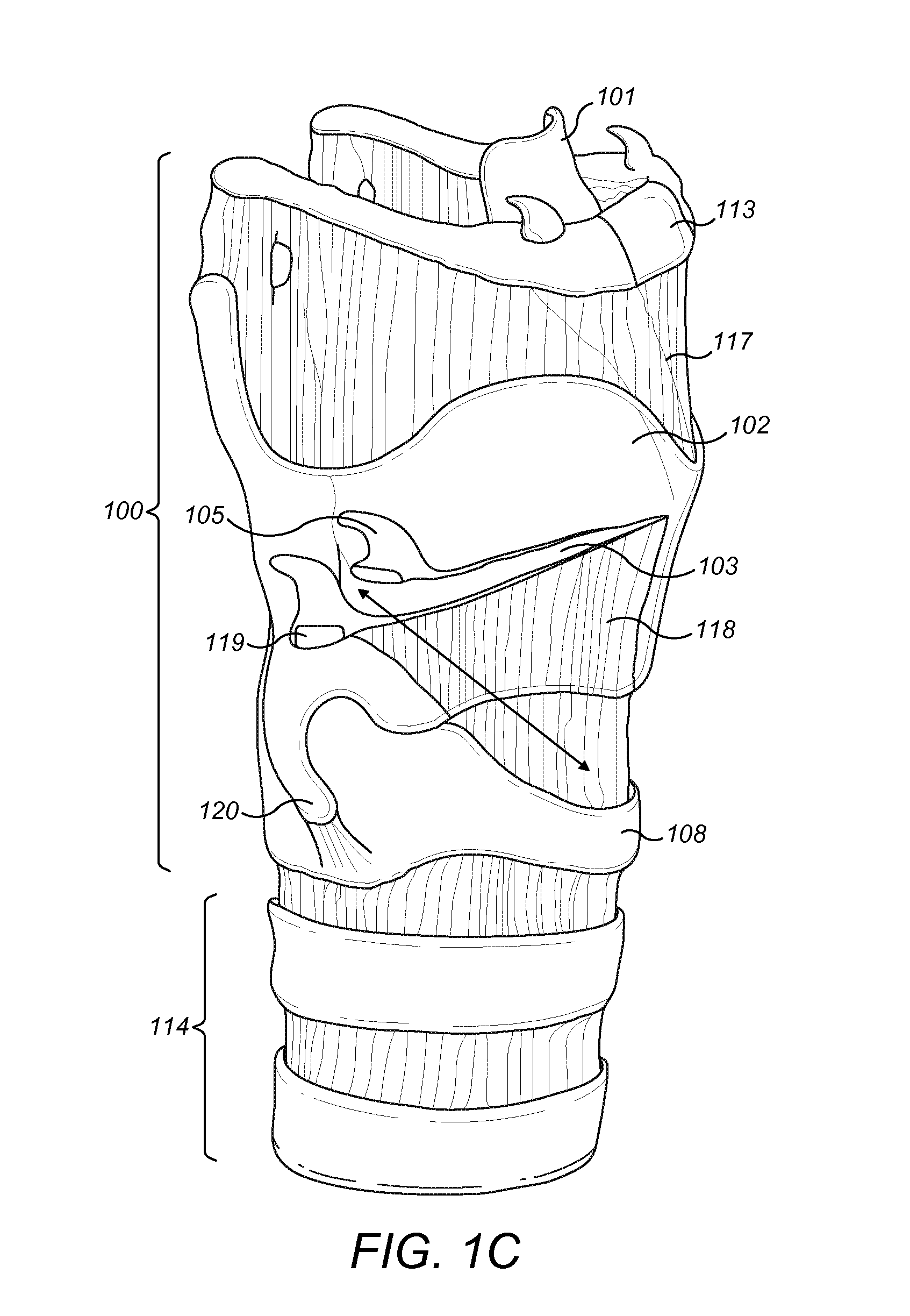 Respiration Sensors for Recording of Triggered Respiratory Signals in Neurostimulators